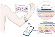 团队开发用于糖尿病管理的下一代可穿戴连续血糖监测系统