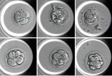 用于评估 IVF 胚胎质量的全自动 AI 系统